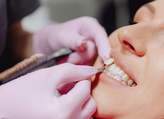 Enhancing Your Smile and Oral Well-Being with Danties Protezas